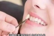 淡黃色是牙醫(yī)公認(rèn)的健康色號，牙醫(yī)專家：健康牙齒的顏色并非純白