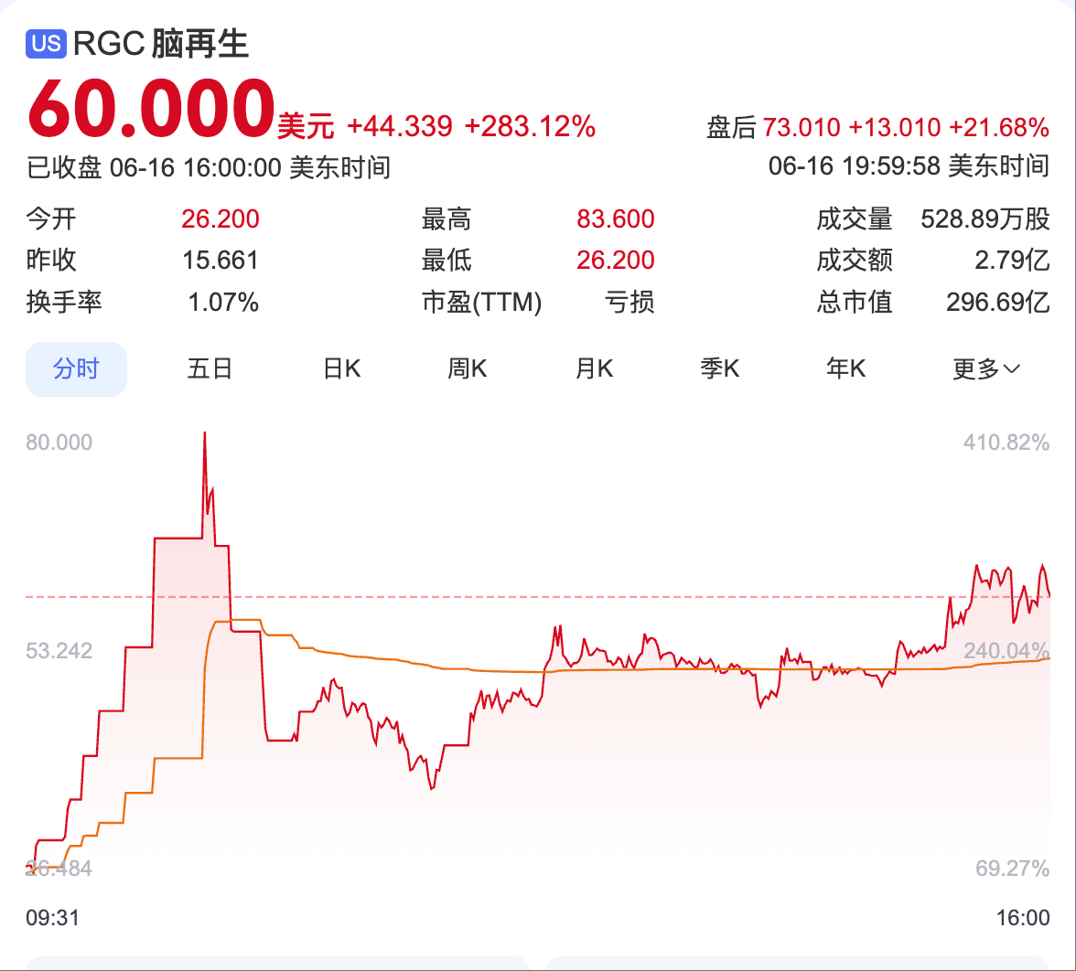 美股腦再生科技股價暴漲283%，港股、A股腦機接口概念股同步狂歡